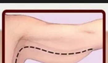 Cómo tornear los brazos y piernas sin salir de casa 