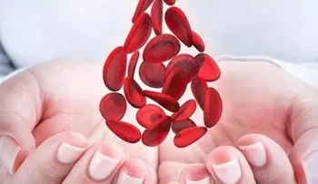 La hemofilia es una enfermedad que se transmite de padres a hijos a través de los genes 