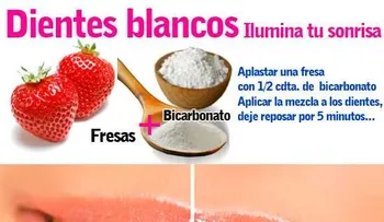 Entérate del mejor remedio para blanquear tus dientes