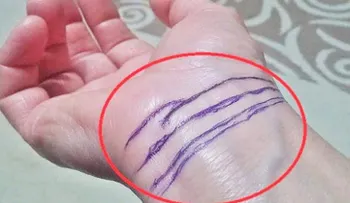 Dime las lineas que tiene en la muñeca y te diré cosas interesantes...