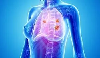 Desarrollan plataforma para detectar cáncer de mama con aliento