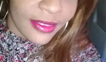 Es nativa de Barahona, joven golpeada en Baní por su marido,familiares piden apresamiento