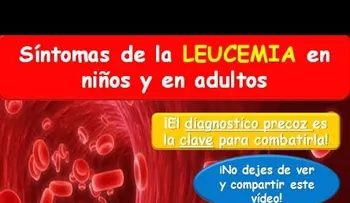 LEUCEMIA: Síntomas en niños y en adulto