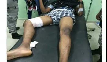 Balean raso policial en competencia clandestina de motores