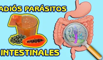 Los parásitos desaparecerán para siempre con un jugo de semilla de papaya (lechosa)