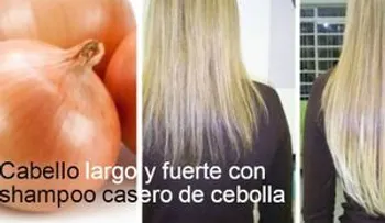Champú de cebolla para el crecimiento del pelo. ¿Por qué no me lo dijeron antes?