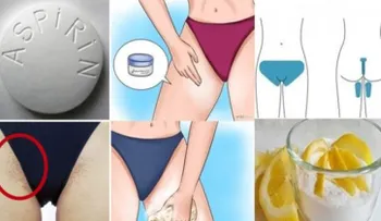 Formas de usar la aspirina que no sabías! La #5 no la conocía