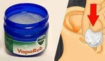 Increíbles usos del VICKS VAPORUB, hasta en la vida sexual, que nadie te había dicho