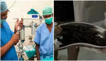 Médicos sacan 116 clavos del estómago de un hombre; duraron más de una hora para sacarlo