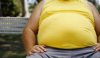 El 26.6% población RD tiene obesidad; 31% en sobrepeso