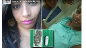 A una brasileña (Jucilene Marinho) le reconstruyen exitosamente la vagina con piel de pescado 