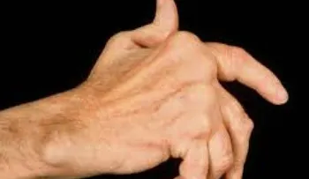40 y 50 porciento población mundial sufre algún tipo de enfermedad reumática