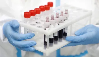 República Dominicana registra cifra record de 710 contagios en un día; fallecidos se elevan a 655