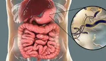 Tratamiento para combatir bacterias en el estómago o ameba