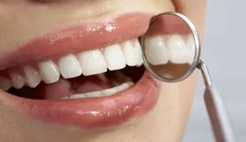 Cinco secretos para nunca tener caries