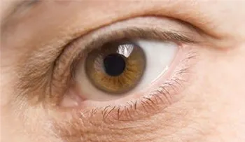 Piel seca alrededor de los ojos causas síntomas y tratamientos naturales