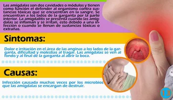 En sólo 4 horas: Curar la amigdalitis y el dolor de garganta 