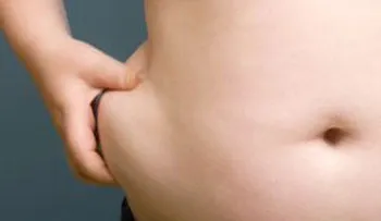 La obesidad fomenta un aumento en las tasas de diabetes.