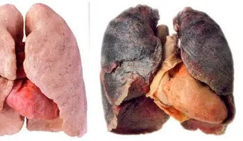 7 señales iniciales y síntomas del cáncer de pulmón, y como prevenirlo 
