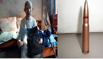 Anciano de 70 años con plomo en su vientre sin saberlo