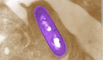 EE.UU: un muerto por brote de listeria; se sospecha de una ensalada