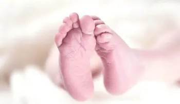 Insólito hecho en la India; nace niña con tres cabezas y causa conmoción