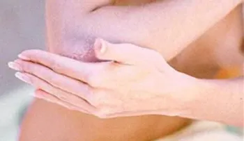 Cuando las células de la piel crecen se presenta la psoriasis