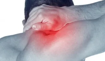 ¿Qué es y cómo se trata el síndrome del cuello roto?