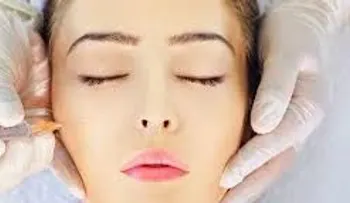 Detalles importantes si deseas aplicarte bótox