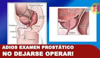 Grupo de Medicina Norteamericano testimonia que la próstata es intocable, y que nunca se deje operar 