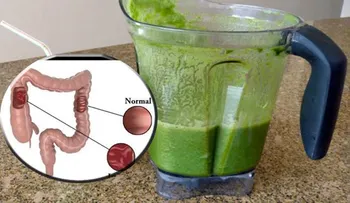 Aprende a mantener saludable tu colon y pierde 5 kilos en 1 semana con este remedio natural