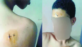 Apuñalan niño de 14 años en escuela de Sabana Perdida