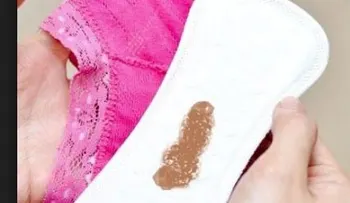 El flujo vaginal color marrón no debe asustar tanto. Tratamiento 