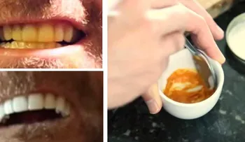 Este hombre tiene un truco ridículamente simple para blanquear sus dientes. Tan sólo usa pasta y un ingrediente secreto