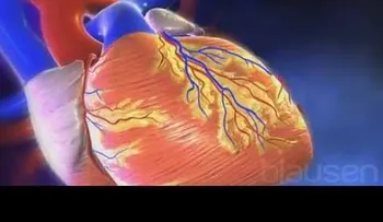 Observa cómo se produce un infarto de miocardio (VIDEO)