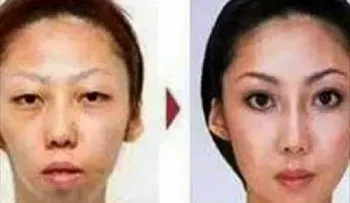Un hombre demanda a su esposa por fea 