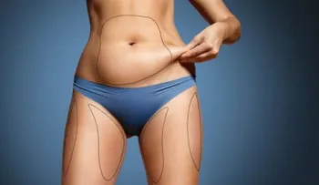 ¿Cómo calcular la grasa corporal? Te enseñamos