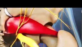 Síndrome del piriforme o piramidal (VIDEO)