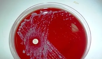 4 medicamentos para tratar la Candidiasis que puedes usar tu médico