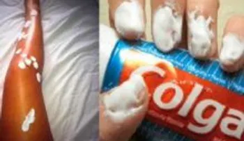 La pasta dental: usos increíbles, no solo para dientes; ella lo unto de sus muslos hasta los pies