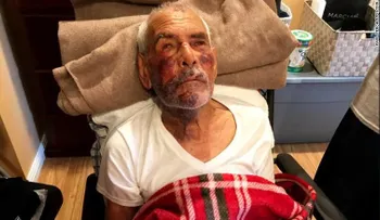 "Vuelve a México"; golpean con un ladrillo a un hombre de 91 años en EE.UU