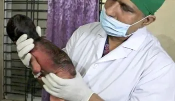 Nace un bebé con el aspecto de una persona de 80 años 