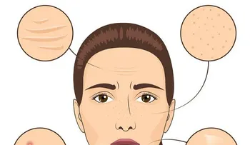 4 consejos para tener una piel más limpia