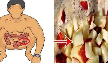 Increíble mira como: limpia tu colon y pierde 10 kilos en 3 semanas con este remedio casero..resultados sorprendentes!!!