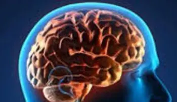 Constatan que alzhéimer se desarrolla en el cerebro de forma muy distinta