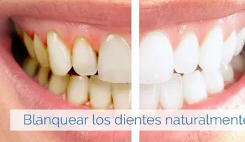 Blanquea tus dientes de manera natural 