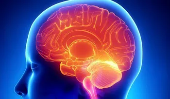 5 efectos muy negativos del azúcar al cerebro: Daña la memoria y provoca otros GRAVES daños