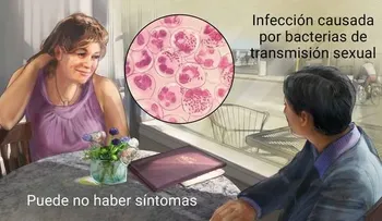 La gonorrea, síntomas y consecuencias