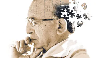 Una terapia logra reducir una proteína vinculada al alzheimer