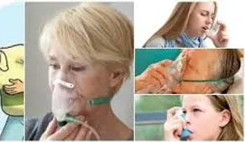 Las causas más comunes en personas con dificultad respiratoria son: Asma, neumonía o enfermedad pulmonar 